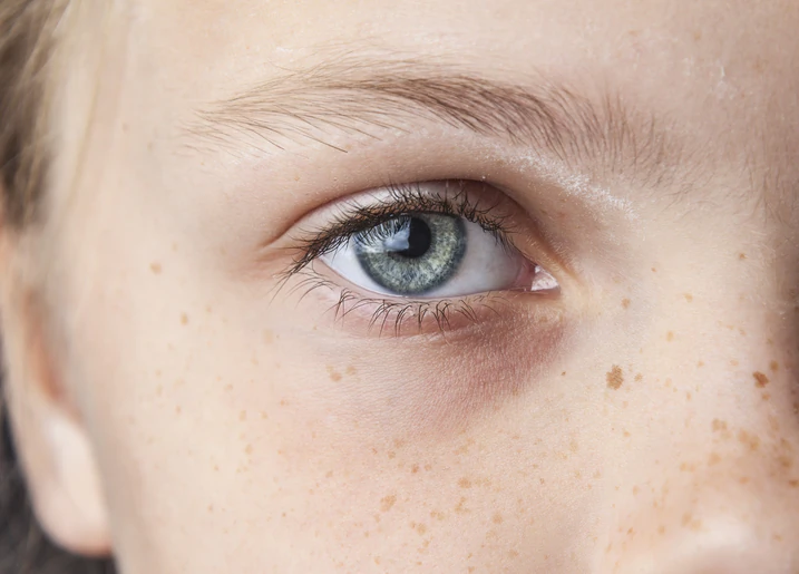 eye