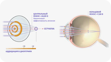 Технология RingBoost - кольцевой фокус