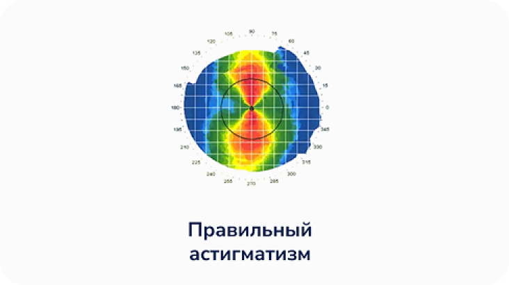 Правильный астигматизм