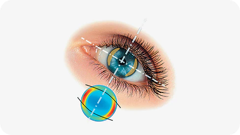 ACUVUE® OASYS with HydraLuxe® for ASTIGMATISM media 1