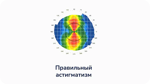 Правильный астигматизм