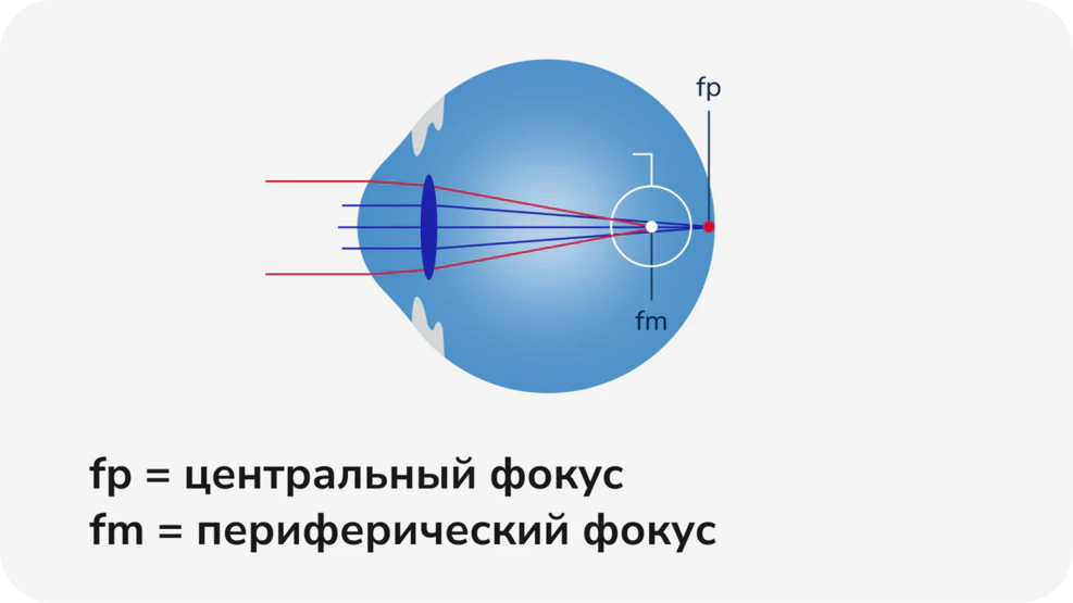 Центральный и периферический фокус